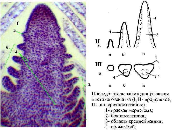 I а II б 4 III в Последовательные стадии развития листового зачатка (I, II-