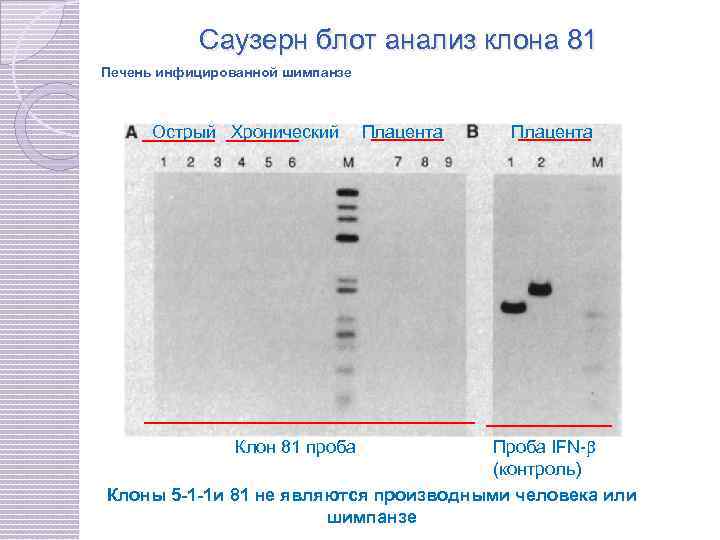 Саузерн блоттинг. Саузерн блоттинг анализ результатов. Саузерн блоттинг детекция результатов. Саузерн-блоттинг цели применения.