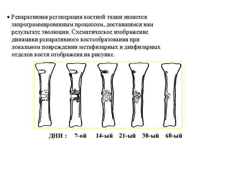  Репаративная регенерация костной ткани является запрограммированным процессом, доставшимся нам результате эволюции. Схематическое изображение