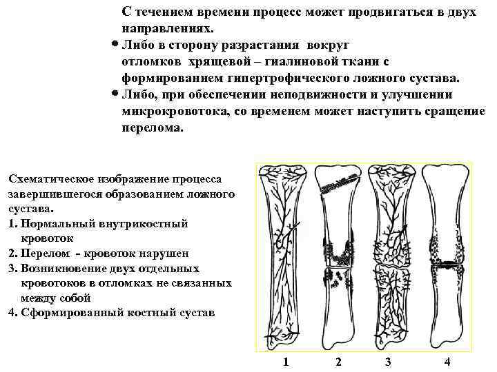 С течением времени процесс может продвигаться в двух направлениях. Либо в сторону разрастания вокруг