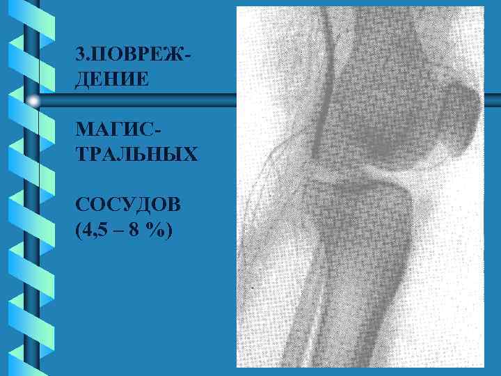 3. ПОВРЕЖДЕНИЕ МАГИСТРАЛЬНЫХ СОСУДОВ (4, 5 – 8 %) 