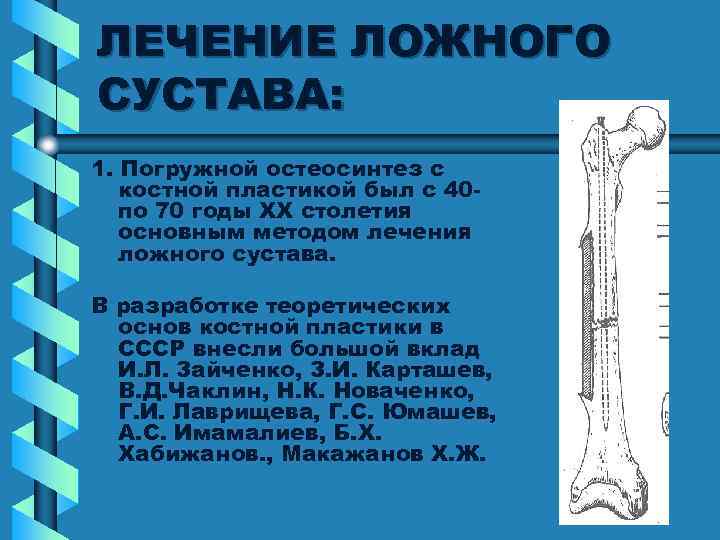 ЛЕЧЕНИЕ ЛОЖНОГО СУСТАВА: 1. Погружной остеосинтез с костной пластикой был с 40 по 70