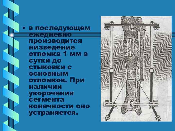  • в последующем ежедневно производится низведение отломка 1 мм в сутки до стыковки