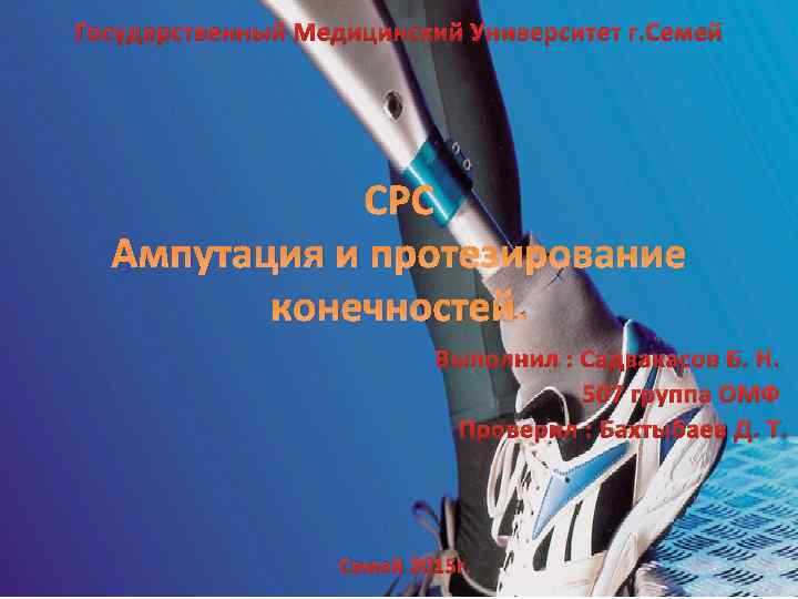 Государственный Медицинский Университет г. Семей СРС Ампутация и протезирование конечностей. Выполнил : Садвакасов Б.