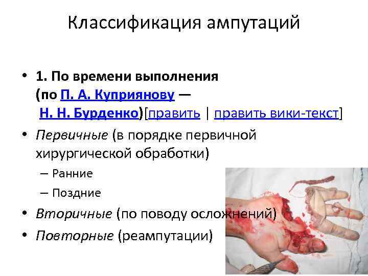 Классификация ампутаций • 1. По времени выполнения (по П. А. Куприянову — Н. Н.