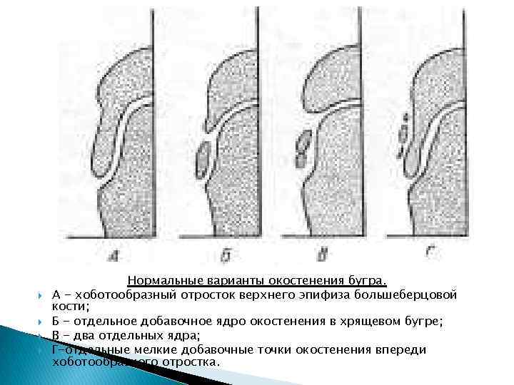 Вариант нормальной