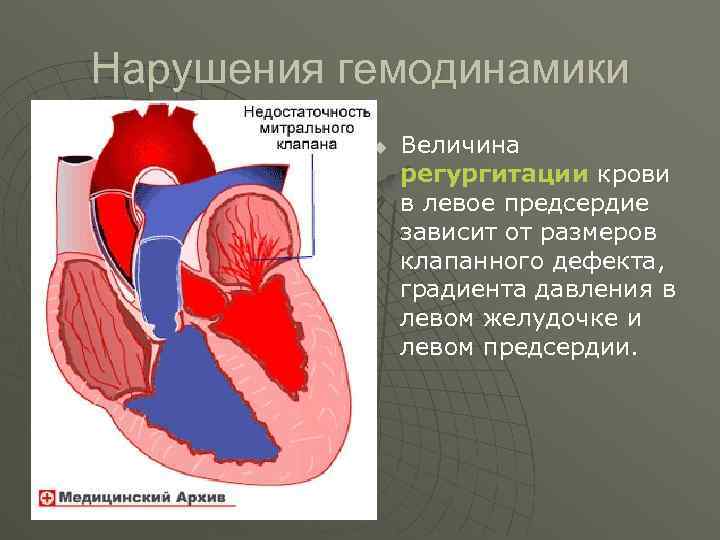 Степень регургитации предсердий