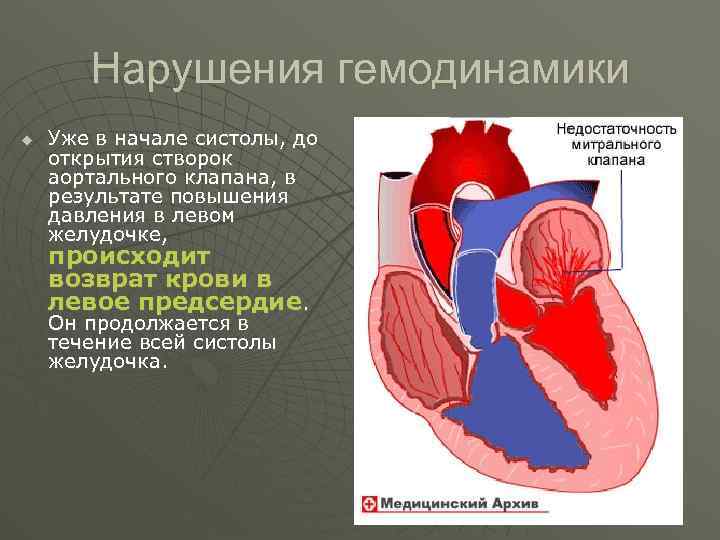 Фиброзные изменения аортального клапана