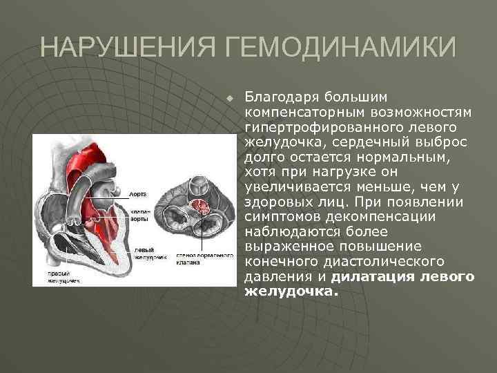 Левый желудочек изменения. Нарушение правого желудочка сердца. Левый желудочек при митральном стенозе. Нагрузка на левый желудочек. Порок левого желудочка сердца.