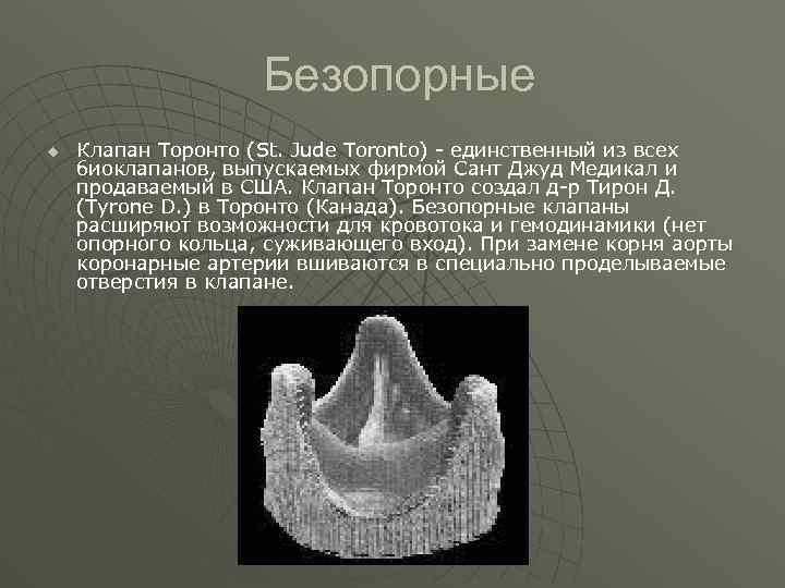 Безопорные u Клапан Торонто (St. Jude Toronto) единственный из всех биоклапанов, выпускаемых фирмой Сант