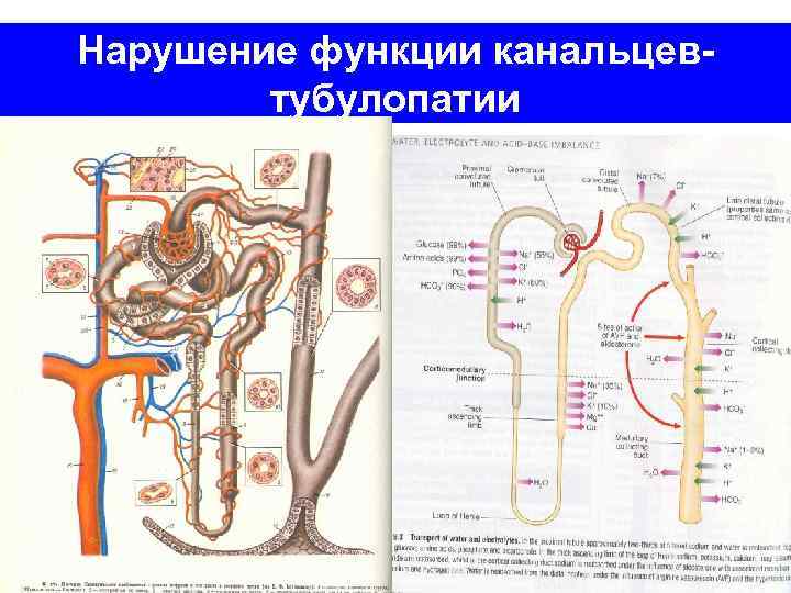 Нарушение функции канальцевтубулопатии 