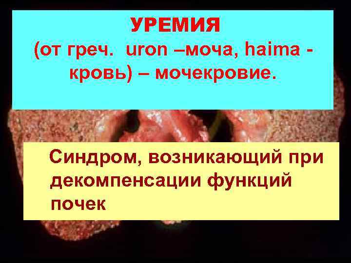 УРЕМИЯ (от греч. uron –моча, haima кровь) – мочекровие. Синдром, возникающий при декомпенсации функций