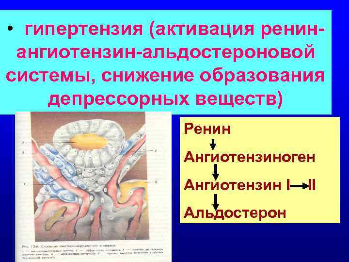  • гипертензия (активация ренинангиотензин-альдостероновой системы, снижение образования депрессорных веществ) Ренин Ангиотензиноген Ангиотензин I
