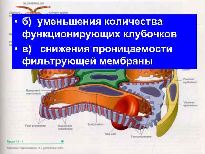 • б) уменьшения количества функционирующих клубочков • в) снижения проницаемости фильтрующей мембраны 