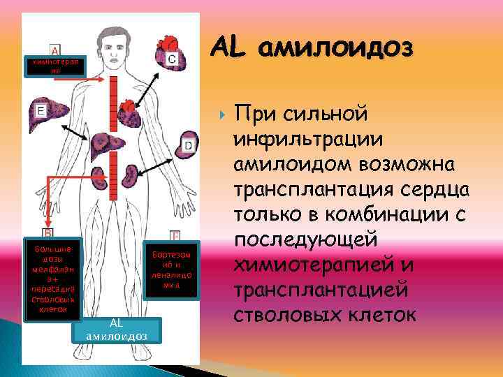 AL амилоидоз химиотерап ия Большие дозы мелфалан а+ пересадка стволовых клеток Бортезом иб и