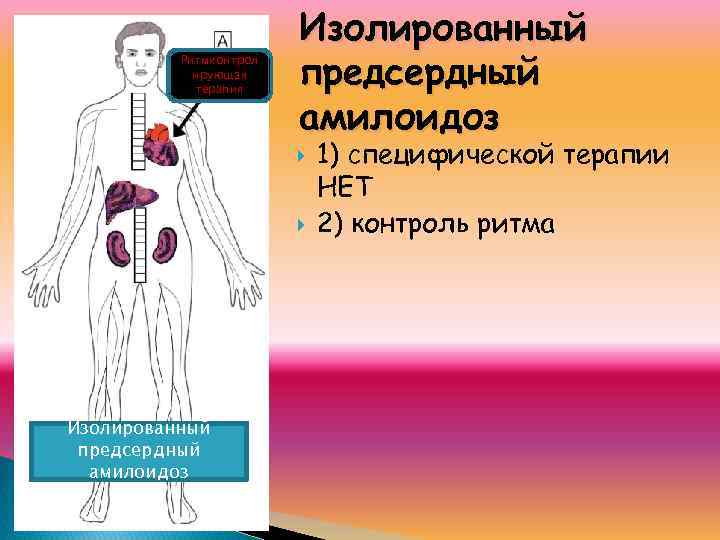 Ритмконтрол ирующая терапия Изолированный предсердный амилоидоз 1) специфической терапии НЕТ 2) контроль ритма 