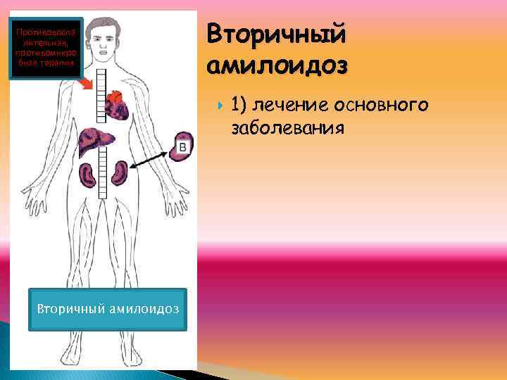 Противовоспа лительная, противомикро бная терапия Вторичный амилоидоз 1) лечение основного заболевания 