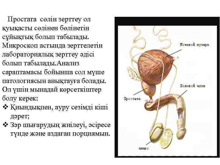 Простата сөлін зерттеу ол қуықасты сөлінен бөлінетін сұйықтық болып табылады. Микроскоп астында зерттелетін лабораториялық