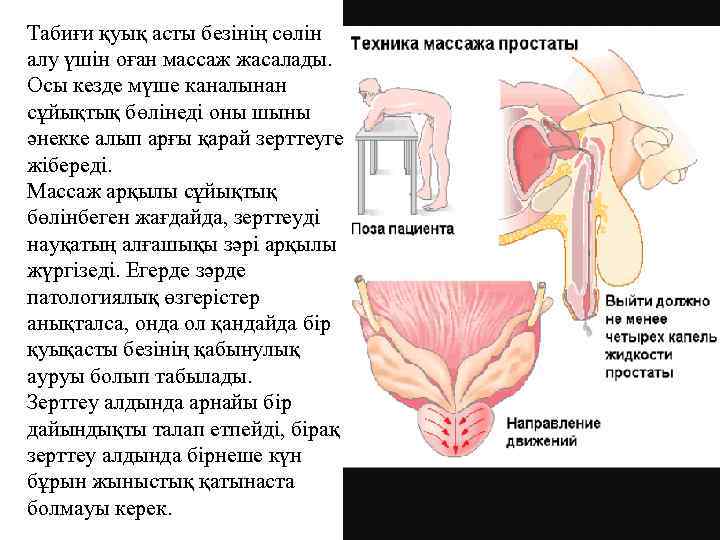 Табиғи қуық асты безінің сөлін алу үшін оған массаж жасалады. Осы кезде мүше каналынан