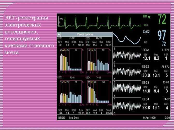ЭКГ-регистрация электрических потенциалов, генерируемых клетками головного мозга. 