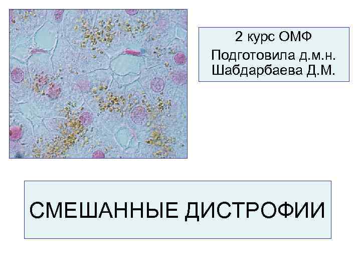 2 курс ОМФ Подготовила д. м. н. Шабдарбаева Д. М. СМЕШАННЫЕ ДИСТРОФИИ 