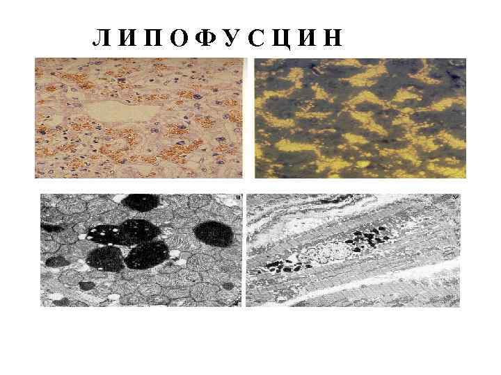 ЛИПОФУСЦИН 