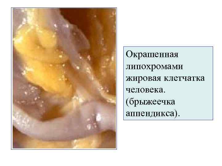 Окрашенная липохромами жировая клетчатка человека. (брыжеечка аппендикса). 