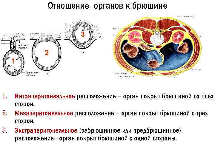 Отношение органов к брюшине 3 2 1 1. Интраперитонеальное расположение – орган покрыт брюшиной