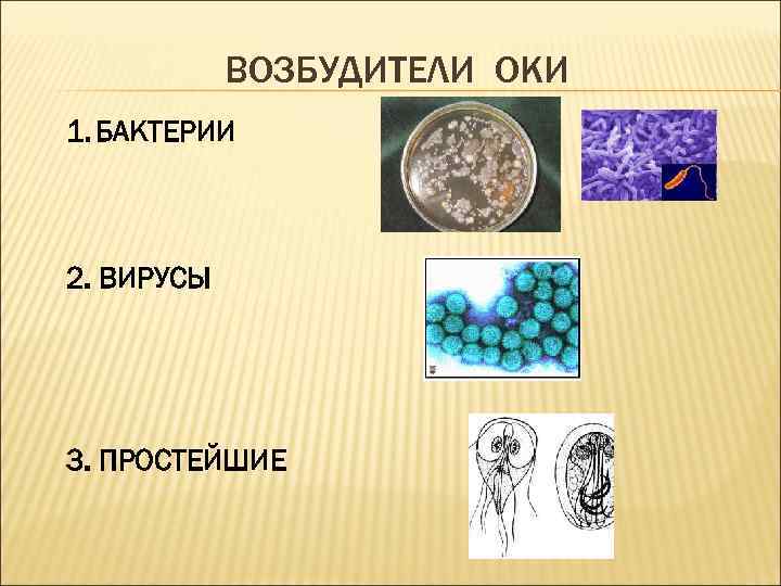 ВОЗБУДИТЕЛИ ОКИ 1. БАКТЕРИИ 2. ВИРУСЫ 3. ПРОСТЕЙШИЕ 