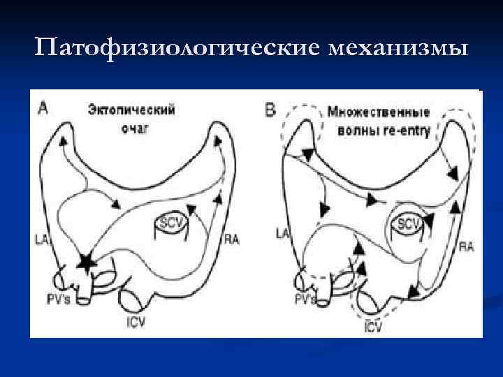 Патофизиологические механизмы 