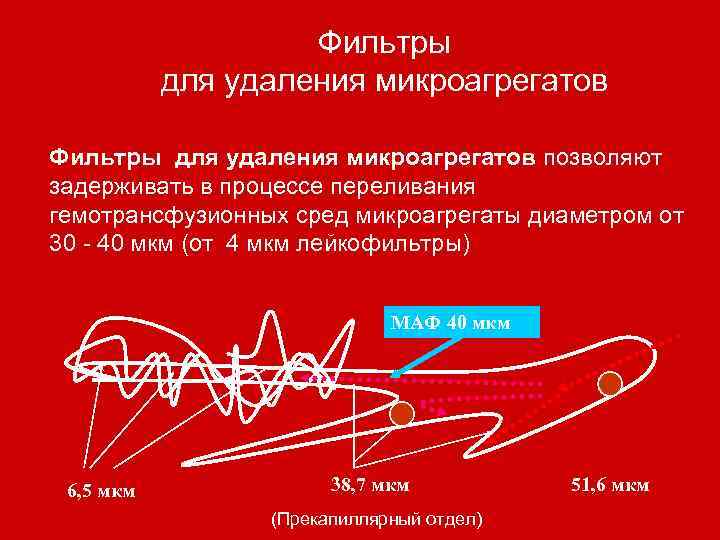 Фильтры для удаления микроагрегатов позволяют задерживать в процессе переливания гемотрансфузионных сред микроагрегаты диаметром от
