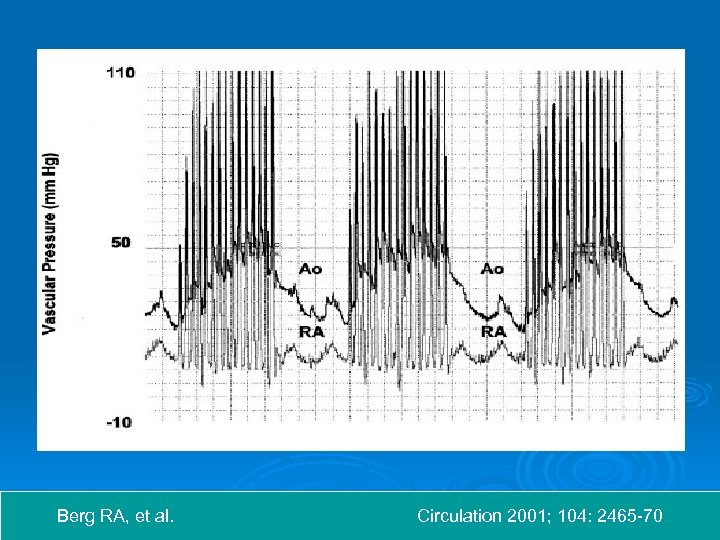 Berg RA, et al. Circulation 2001; 104: 2465 -70 