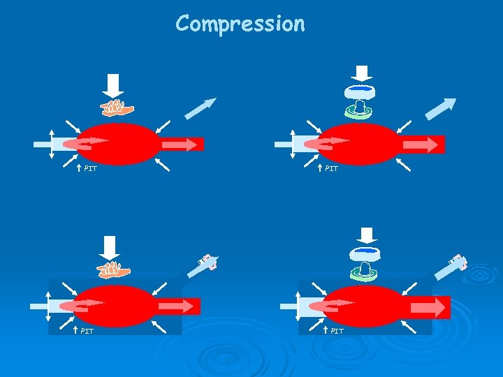 Compression PIT 
