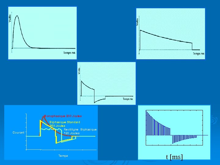 Monophasique 200 Joules Courant Biphasique Standard 150 Joules Rectiligne Biphasique 120 Joules 15 RB