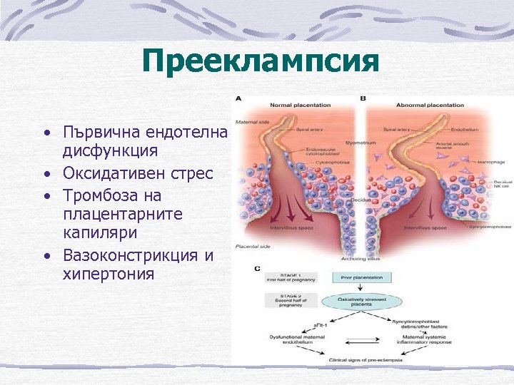 Прееклампсия • Първична ендотелна дисфункция • Оксидативен стрес • Тромбоза на плацентарните капиляри •