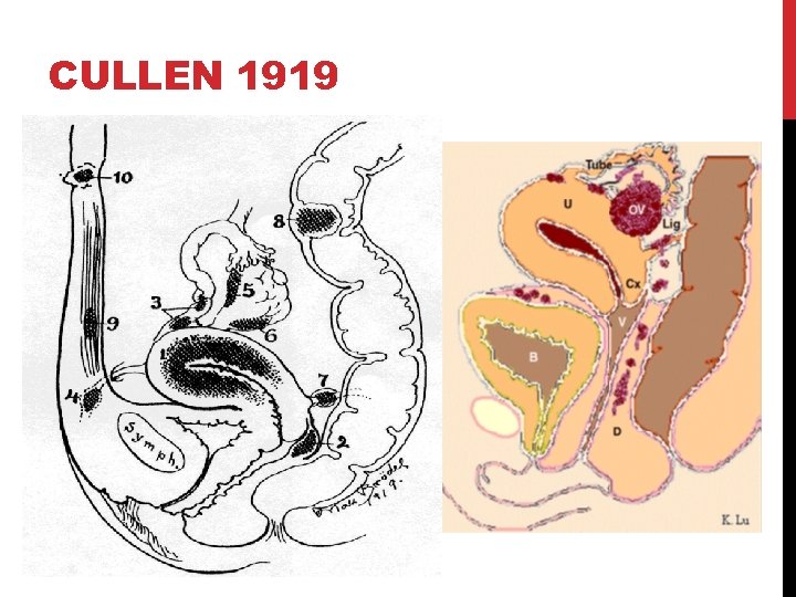 CULLEN 1919 