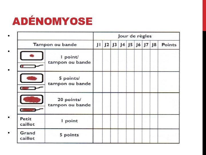 ADÉNOMYOSE • Définition: présence de glandes et de stroma endométriaux dans le myomètre. •