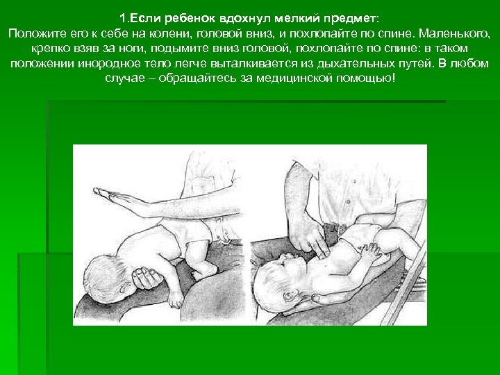 1. Если ребенок вдохнул мелкий предмет: Положите его к себе на колени, головой вниз,