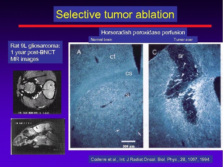 Selective tumor ablation Horseradish peroxidase perfusion Normal brain Tumor scar Rat 9 L gliosarcoma: