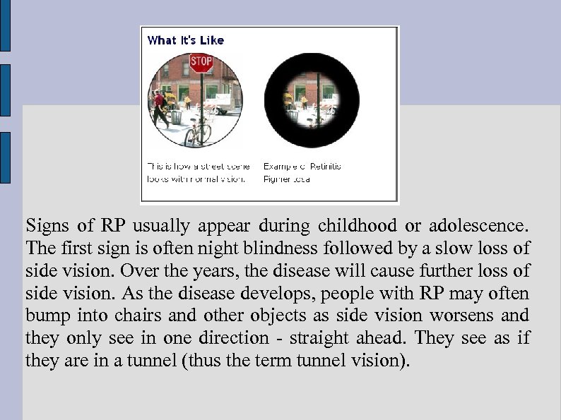 Signs of RP usually appear during childhood or adolescence. The first sign is often