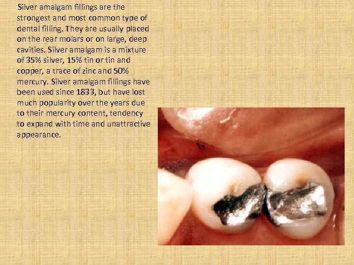  Silver amalgam fillings are the strongest and most common type of dental filling.