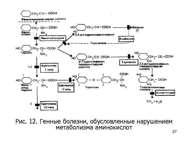 Рис. 12. Генные болезни, обусловленные нарушением метаболизма аминокислот 27 