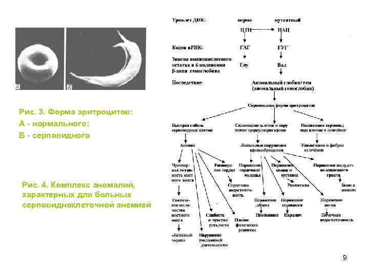 Рис. 3. Форма эритроцитов: А - нормального; Б - серповидного Рис. 4. Комплекс аномалий,