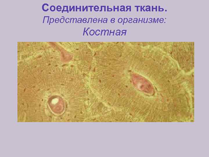 Соединительная ткань. Представлена в организме: Костная 