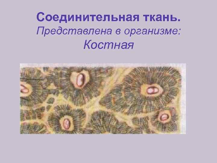 Соединительная ткань. Представлена в организме: Костная 