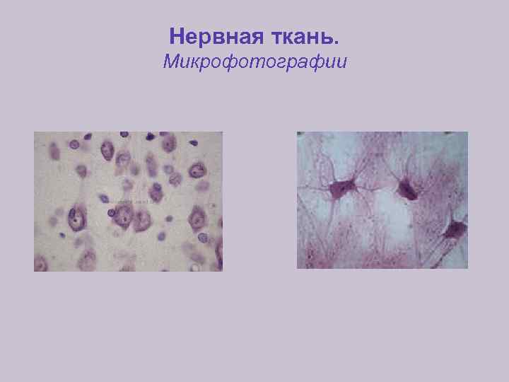 Нервная ткань. Микрофотографии 