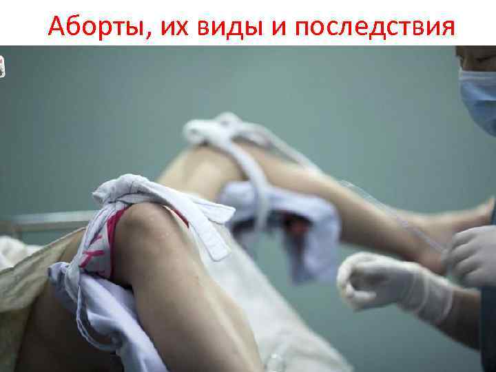 Аборты, их виды и последствия 