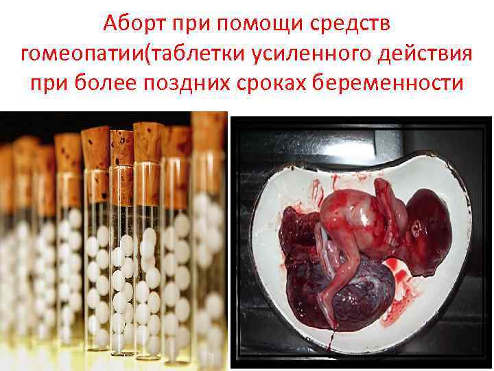 Аборт при помощи средств гомеопатии(таблетки усиленного действия при более поздних сроках беременности 
