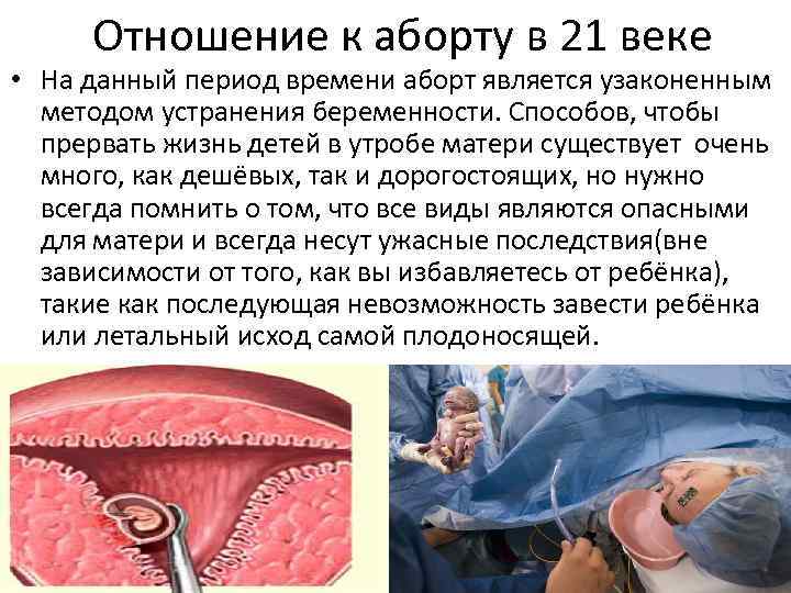 Отношение к аборту в 21 веке • На данный период времени аборт является узаконенным
