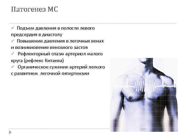 Патогенез МС Подъем давления в полости левого предсердия в диастолу ü Повышение давления в